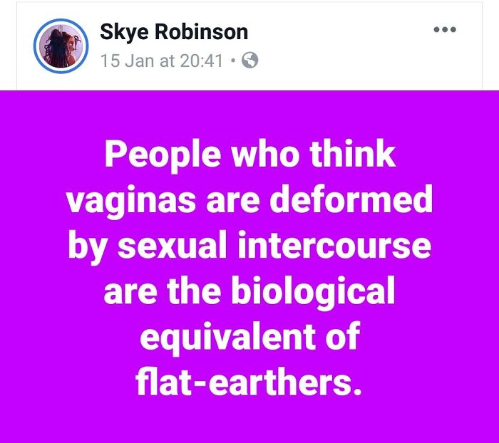 questions to ask - Skye Robinson 15 Jan at . People who think vaginas are deformed by sexual intercourse are the biological equivalent of flatearthers.