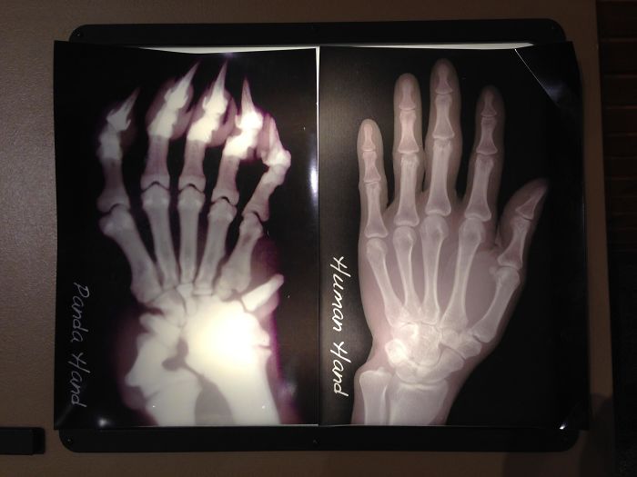 panda hand x ray - Human Hand Panda Hand
