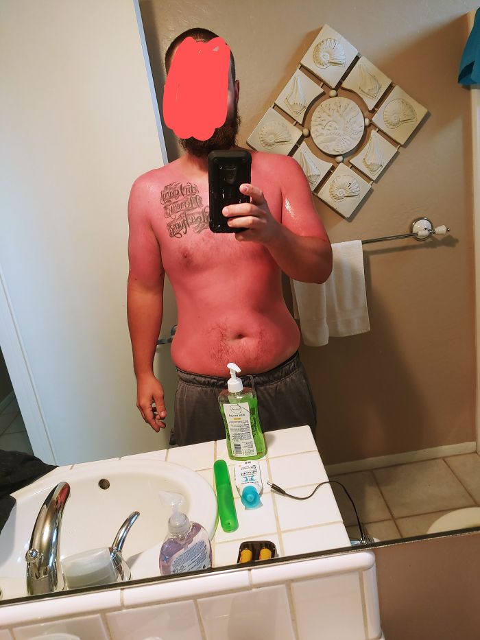 When You Are From Arizona And Think 70 Degrees On The Beach In Cali Doesnt Require Sunscreen