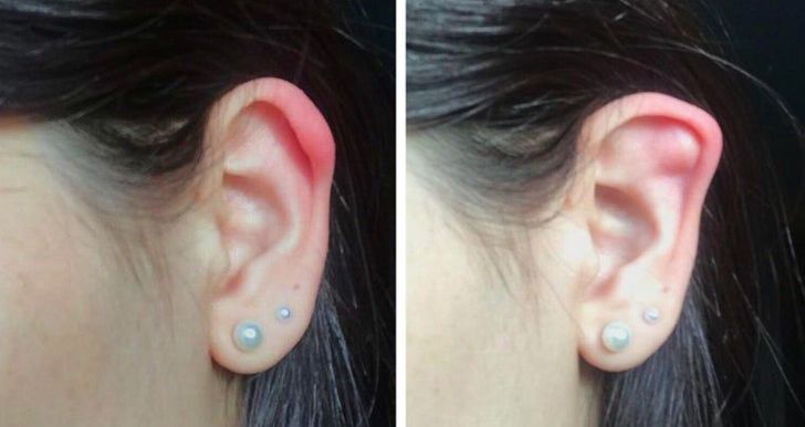 ear