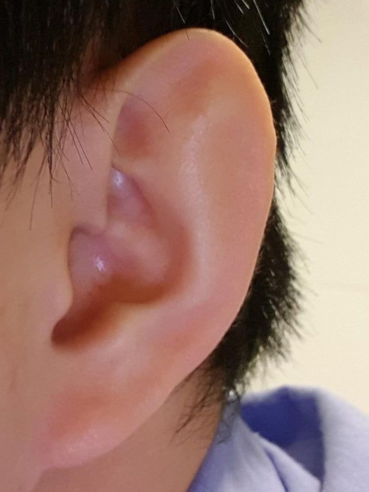 ear