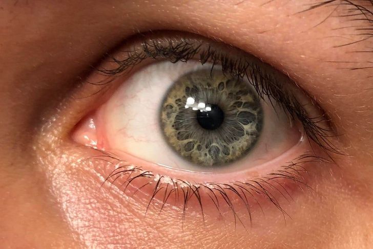 eye