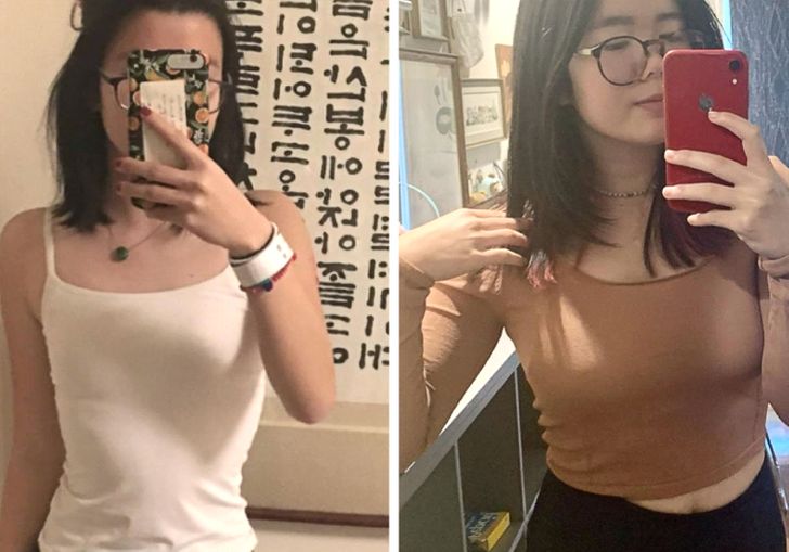 “Here’s an update on my anorexia recovery. It’s been 2 years and I feel strong!”