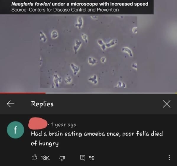 funny roasts - Had a brain eating amoeba once, poor fella died of hungry