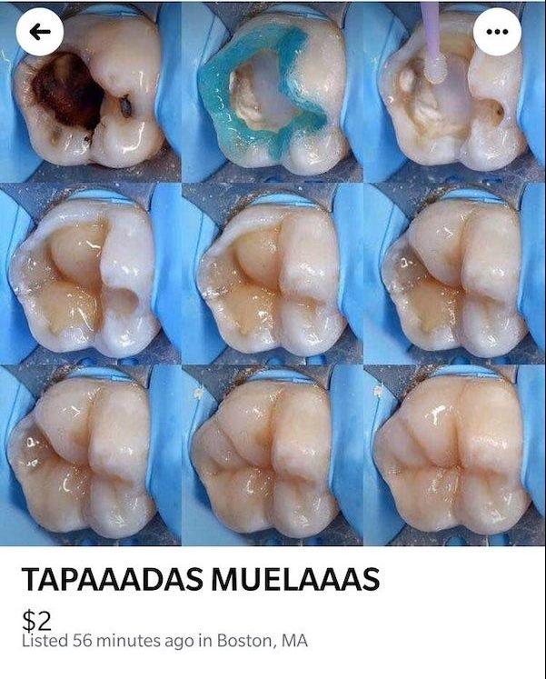 tooth - ... K Tapaaadas Muelaaas $2 Listed 56 minutes ago in Boston, Ma