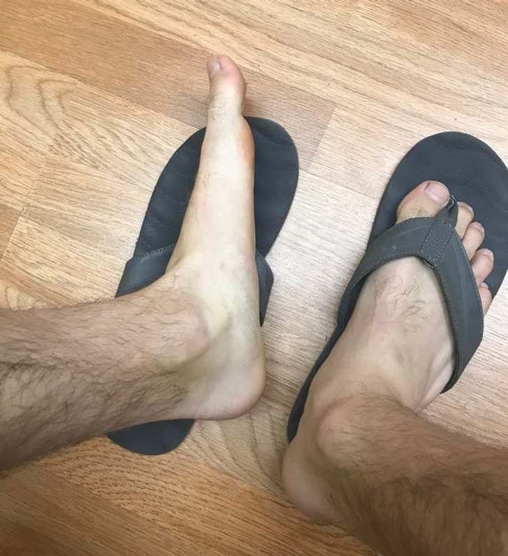 “My feet are totally flat.”