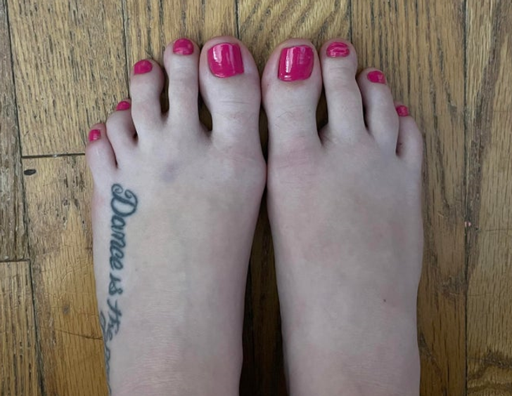 “I was born with 4 toes on one foot.”