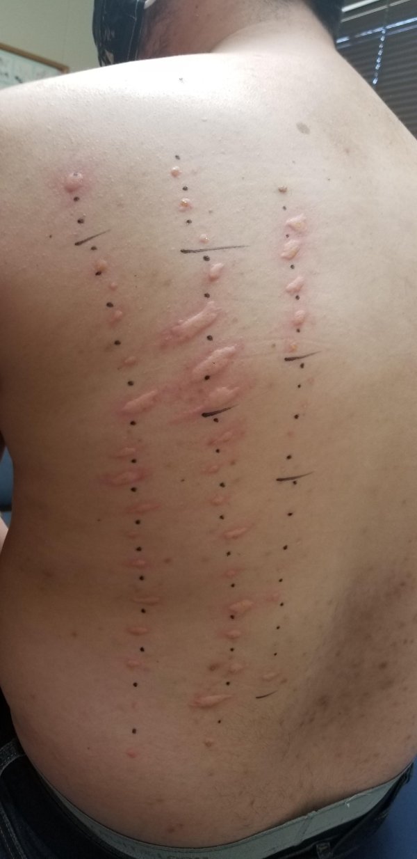 “Just got my allergy test. I’m allergic to every plant and animal in the state of Utah.”