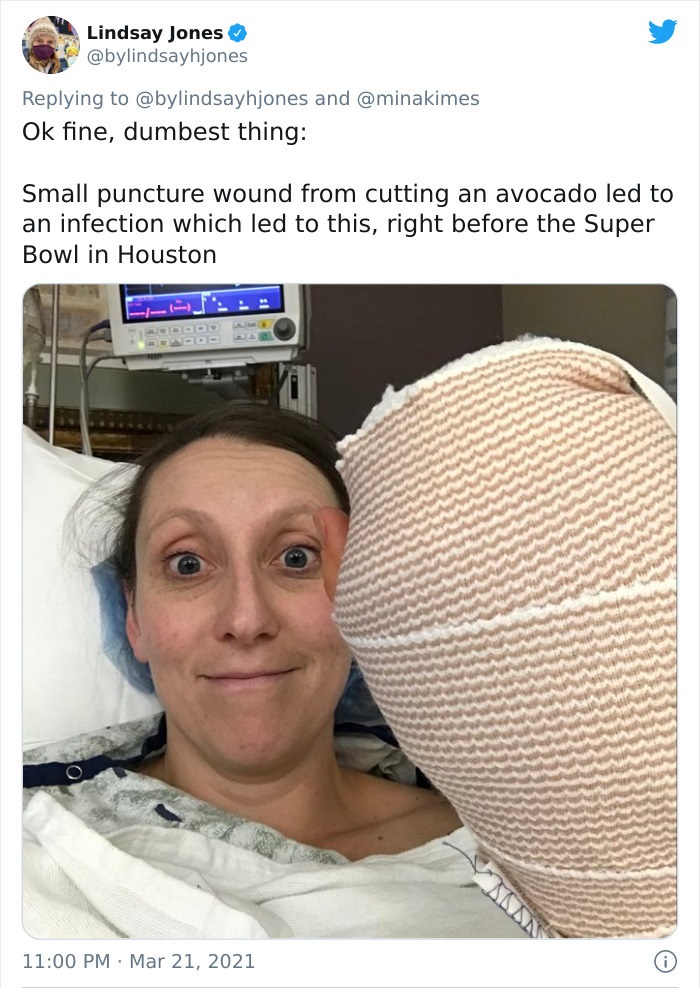 funny injury fails -- Ok fine, dumbest thing Small puncture wound from cutting an avocado led to an infection which led to this, right before the Super Bowl in Houston