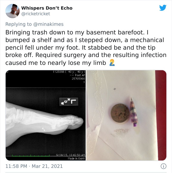 funny injury fails - Bringing trash down to my basement barefoot. I bumped a shelf and as I stepped down, a mechanical pencil fell under my foot. It stabbed be and the tip broke off. Required surgery and the resulting infection caused me to nearly