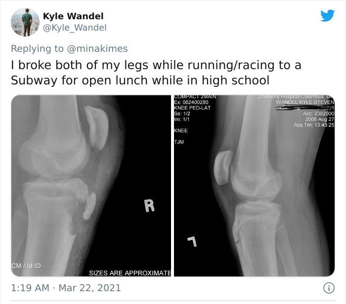 funny injury fails - I broke both of my legs while running/racing to a Subway for open lunch while in high school