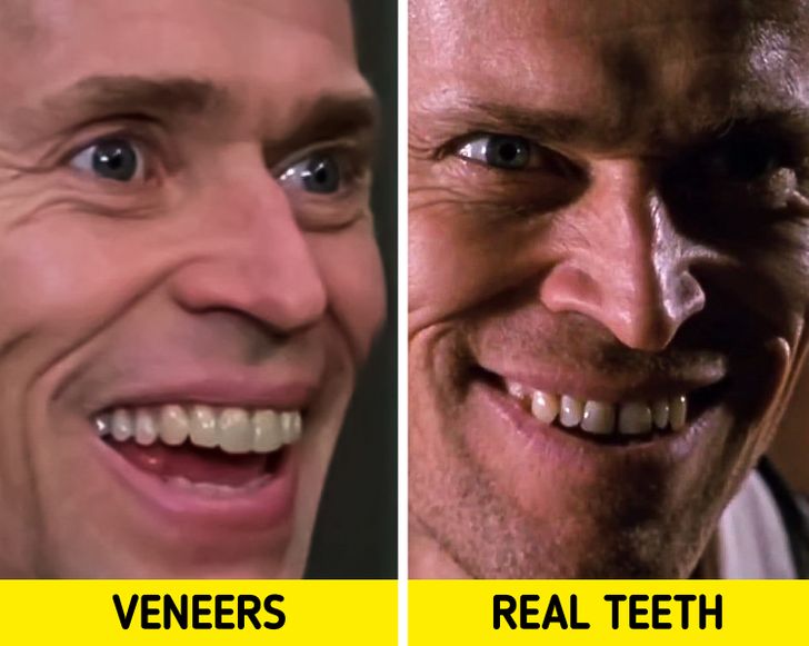 Willem Dafoe had to be fitted with prosthetic teeth when he took the role of Norman Osbourne in Spider-Man. Producers didn’t think a person as rich as Norman Osbourne would walk around without getting his teeth fixed. Willem Dafoe’s real teeth can be seen in the scenes in which Norman Osbourne is having a conversation with himself in the mirror.