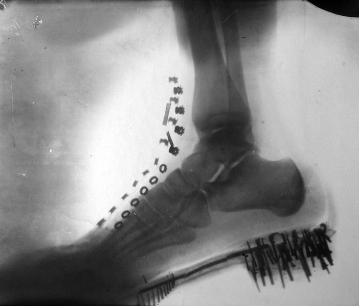 “Nikola Tesla's foot on an X-ray image taken by himself on a device of his own design, 1896.”