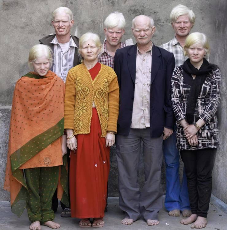 “Albino Indians.”