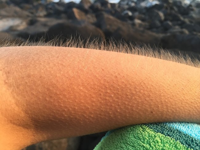 Goosebumps are actually caused by a muscle called the arrector pili muscle.