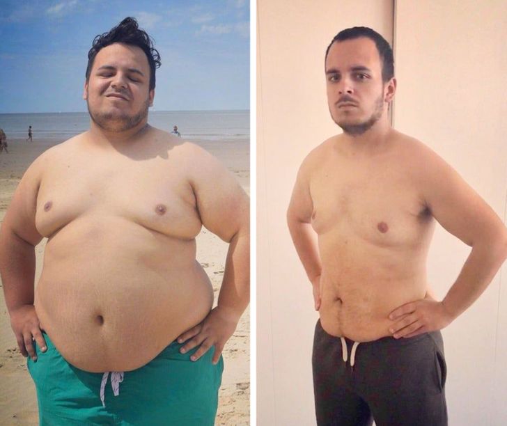 “From morbidly obese to 132 lb less”