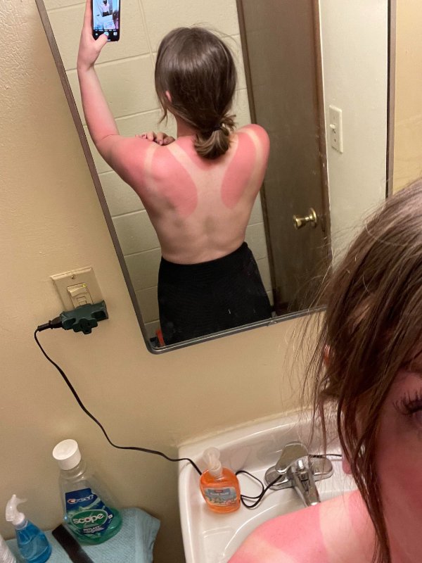 “Went for a hike, it was 60 degrees with snow on the mountains. I fell through the ice/snow every 5 steps and turned around not even halfway through. Got home and realized I also got absolutely burnt as well.”