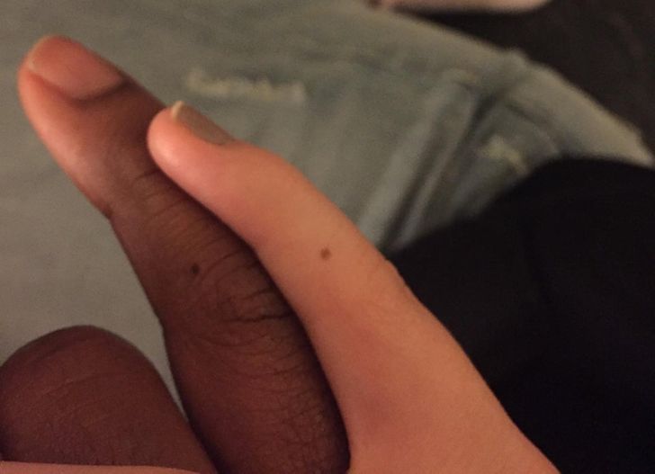 “My boyfriend and I have the same birthmark on the same finger in the same location.”