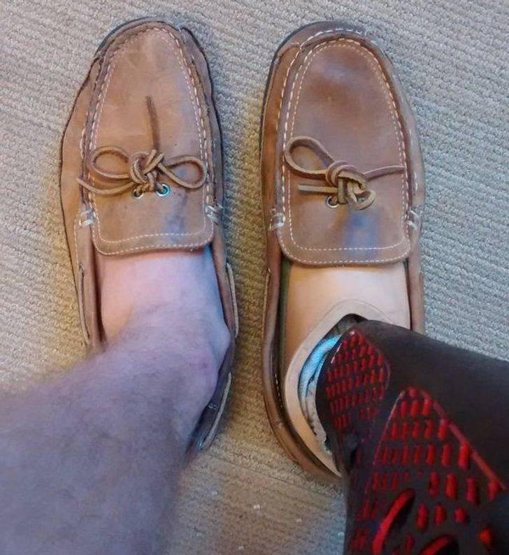 “The difference in shoe wear between my regular foot and my prosthetic foot after a year”