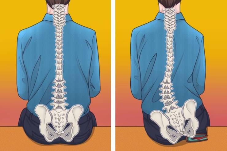 "Why you shouldn’t keep your wallet in your back pocket"
"It’s bad for your spinal cord. If you sit on it, there will be an asymmetry that might lead to pain."'