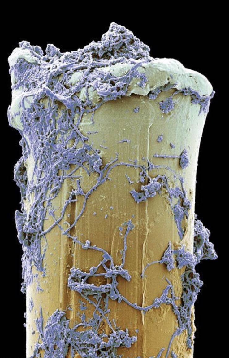 fascinating photos  - dental plaque microscope