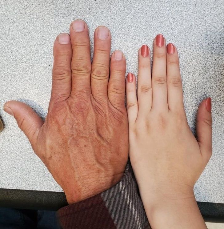 “I inherited this small gap between my middle finger and ring finger from my dad. Both hands are like this.”