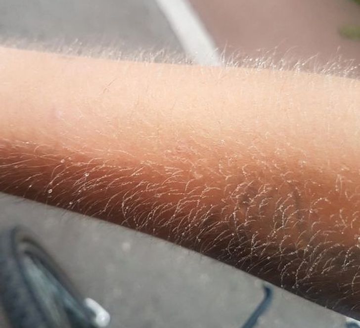 “My arm after biking through heavy fog at 5 AM”