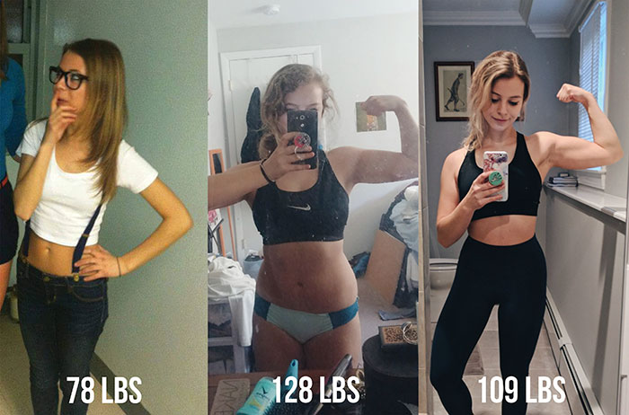 22 People Who Beat Anorexia.