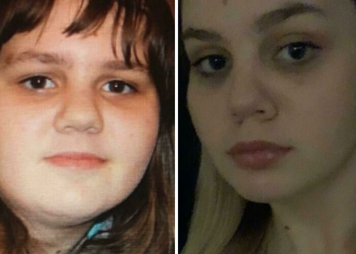 12 > 18 I Was Bullied At School For My Looks, Cried Every Day And Begged World To Give Me Another Face. I Was Kinda Cute Tho