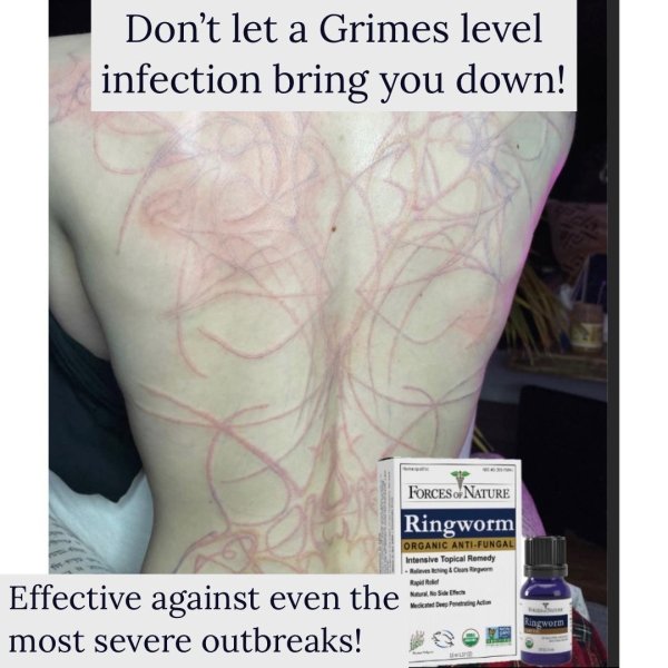 break up quotes - Don't let a Grimes level infection bring you down! Forces Nature Ringworm Organic AntiFungal Intensive Topical Remedy Effective against even the most severe outbreaks! Ringworm