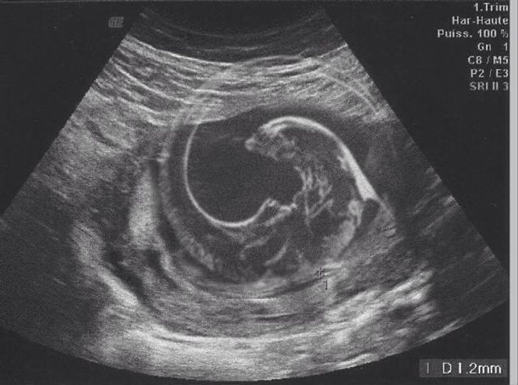 This husband replaced his baby’s ultrasound with a photo of a xenomorph and the wife sent it to all their relatives without realizing it.