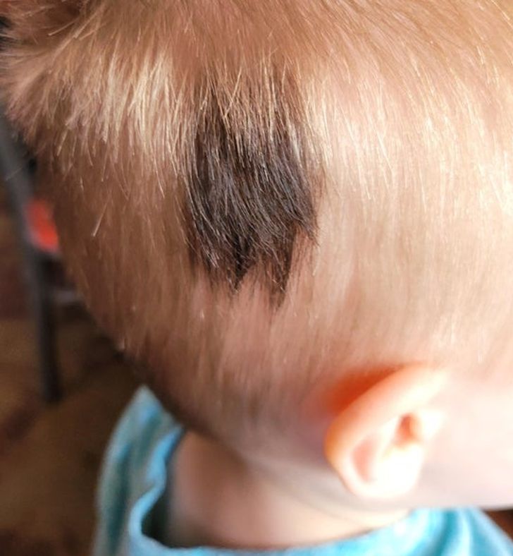 “My son was born with a black spot in his otherwise blonde head of hair. It grows in black, and there is no birthmark or discoloration under it.”