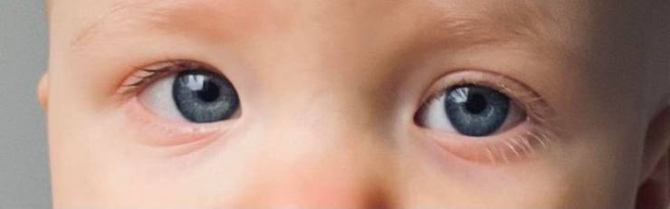 “My daughter has different color eyelashes.”