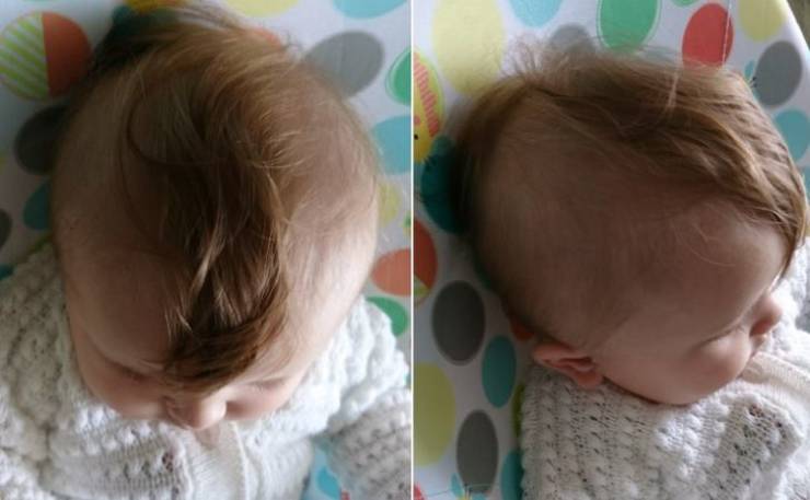 “My daughter’s hair is falling out leaving a little mohawk.”