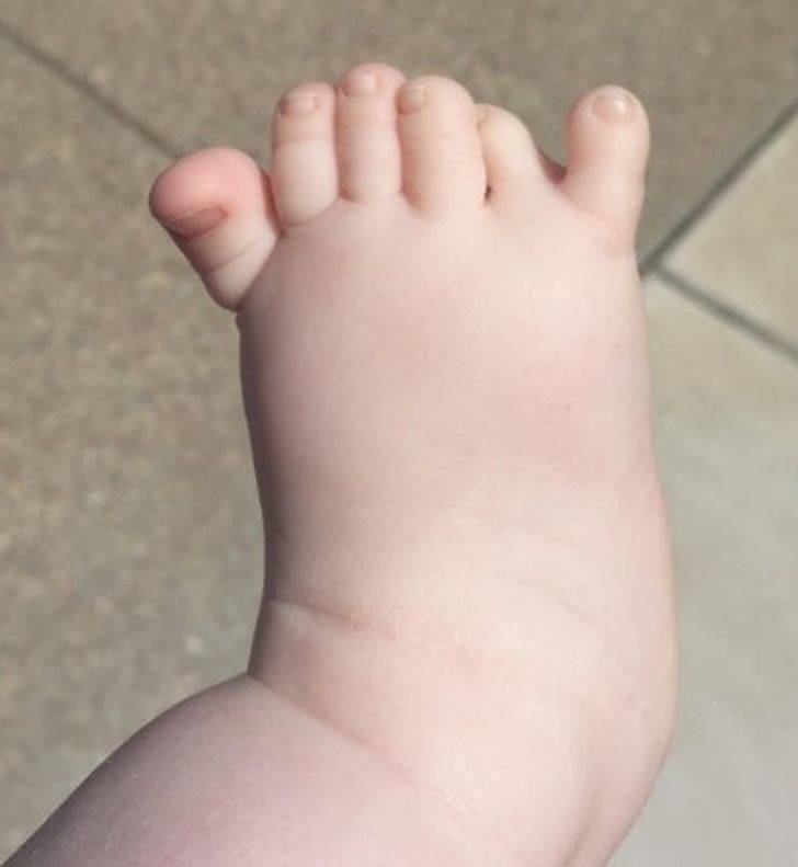 “Met a new cousin yesterday with 6 toes.”