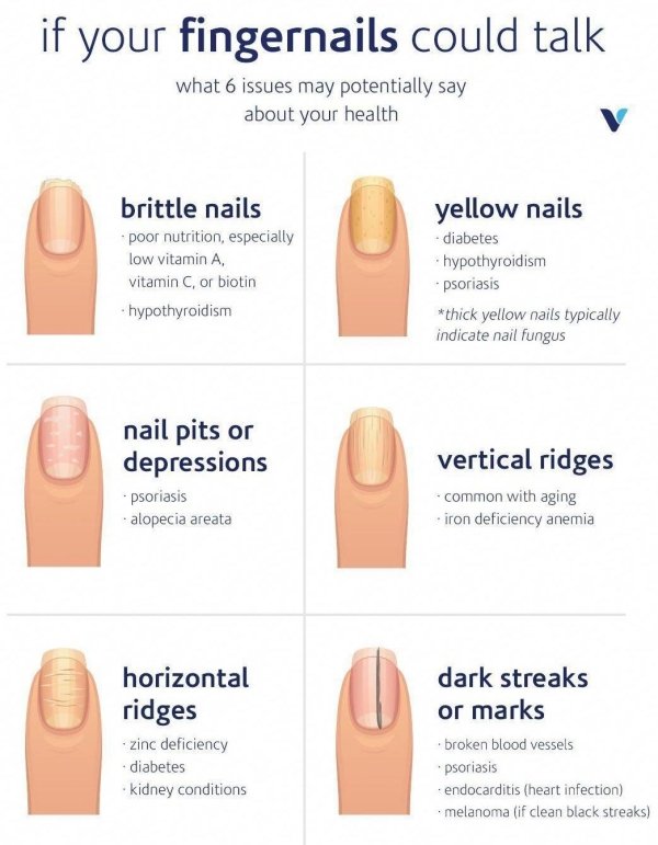 your nails say about your health - if your fingernails could talk what 6 issues may potentially say about your health brittle nails poor nutrition, especially low vitamin A vitamin C, or biotin hypothyroidism yellow nails diabetes hypothyroidism psoriasis