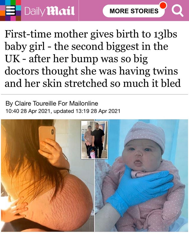 media - Daily Mail More Stories Firsttime mother gives birth to 13lbs baby girl the second biggest in the Uk after her bump was so big doctors thought she was having twins and her skin stretched so much it bled By Claire Toureille For Mailonline , updated