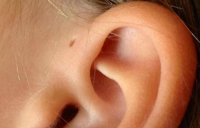 Less than 1% of people have this small little hole right on their ear. Some evolutionary biologists claim this used to be a gill on humans.