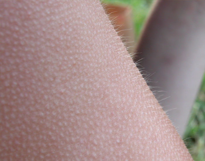 Less than 1% of people can give themselves goosebumps on command. The majority of people get them when they're cold or listening to music, but some can give themselves goosebumps whenever they want to.