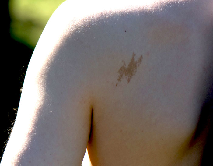 Only 10% of people have birthmarks. They're usually oval in shape and come in a coffee type color.