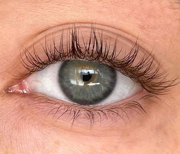 1% of people have a double row of eyelashes. While this might look like something a lot of you are jealous of, it actually can cause a lot of problems.