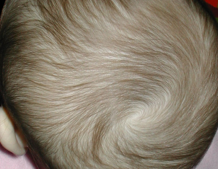 8.4% of people have a counterclockwise hair whorl on their head, while the majority has a clockwise one.