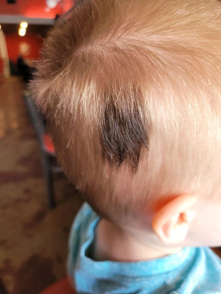 “My son was born with a black spot of hair in his blonde hair. It grows in black, and there is no birthmark or discoloration under it.”