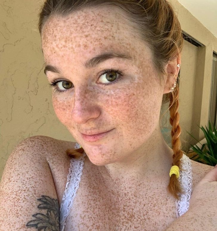 No such thing as too many freckles