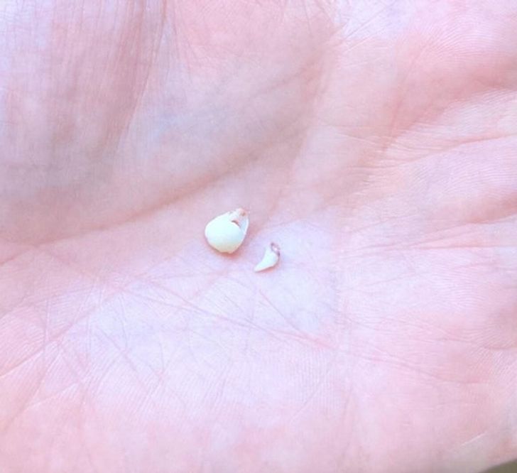 “My daughter and my kitten lost their baby teeth on the same day.”