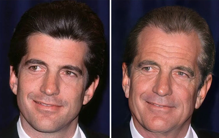 tom cruise smile before after