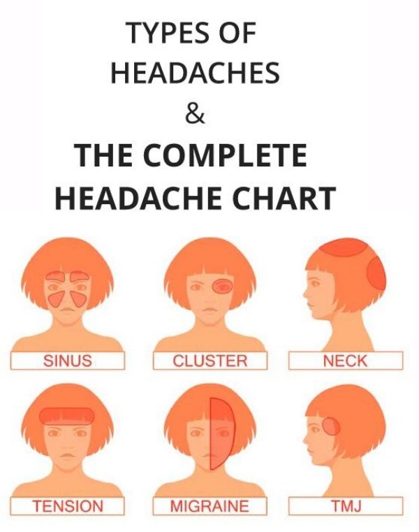 cartoon - Types Of Headaches & The Complete Headache Chart Sinus Cluster Neck Tension Migraine Tmj