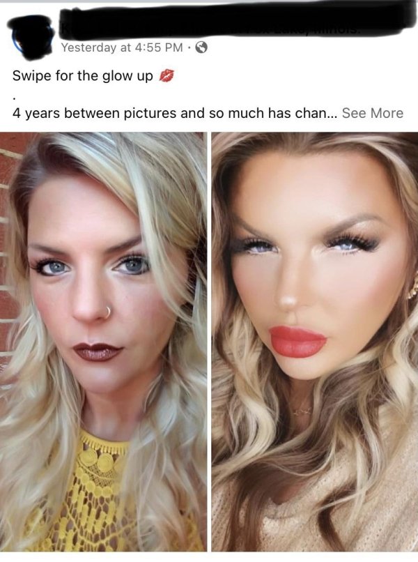 photoshop fails - lip - Yesterday at Swipe for the glow up 4 years between pictures and so much has chan... See More