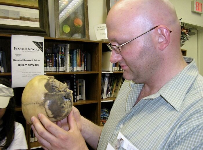Popular myths can often inspire pop culture, but in this case, it's the other way around. In 1999, paranormalist and former Magnum, P.I. writer Lloyd Pye introduced the world to a misshapen skull he claimed as proof of extraterrestrial life. The "Starchild skull" is child-sized and features an enlarged cranium, a flattened back, and no sinuses. Pye also claimed the skull's teeth were much more worn down than a child's would be, and that it was made of organic materials unknown to science. Pye believed the skull belonged to an alien-human hybrid with a human mother and extraterrestrial father, resembling the "little grey men" depicted by sci-fi author Whitley Strieber and the TV show The X-Files.

But scientists who examined the Starchild skull didn't agree. A dentist who examined the skull's teeth concluded that it belonged to a child aged about 5 years old. A neurologist found that the skull's deformations are consistent with congenital hydrocephalus, and DNA tests concluded the remains were entirely human in origin.