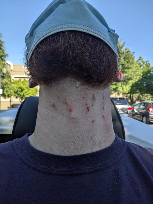 “Went to a barber for a neck shave two days before my wedding…”